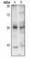 Anti-PINK1 (pS402) Antibody